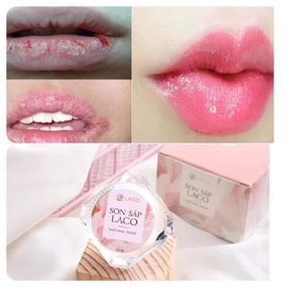 SON SÁP LACO GIẢM THÂM MÔI, MÔI KHÔ, BONG TRÓC 100% THIÊN NHIÊN CAM KẾT AN TOÀN 💋💋