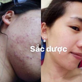 Sắc dược đông y
