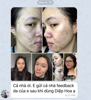 Serum Thảo Mộc OGANA