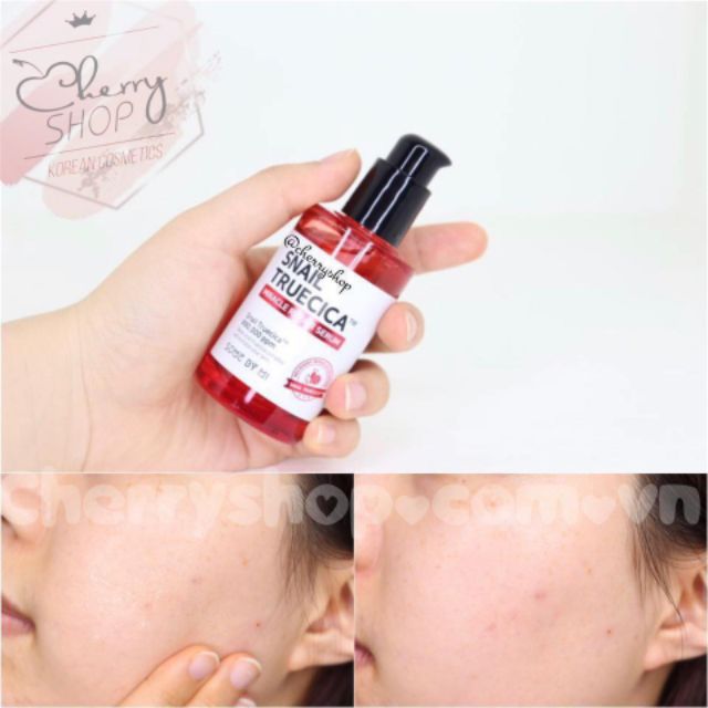 Tinh chất làm mờ sẹo, dưỡng trắng some by mi snail truecica miracle repair 50ml | BigBuy360 - bigbuy360.vn