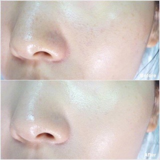 (Hộp 6 miếng) Set mặt nạ thải độc rau củ Super Vegitoks Mask Hàn Quốc