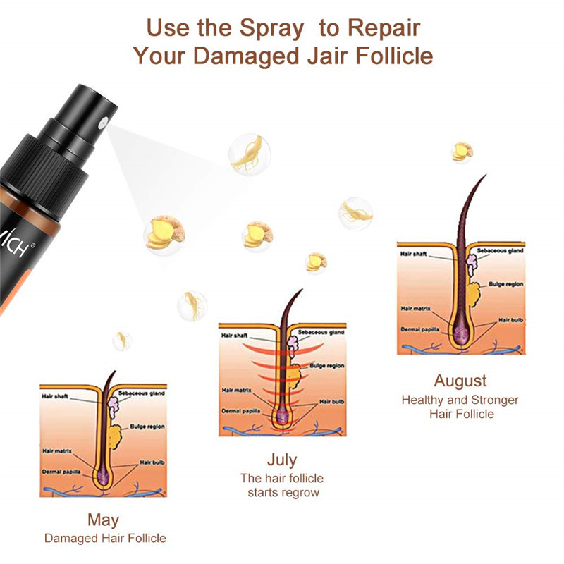 Combo Dầu Gội 200ml，Xịt dưỡng tóc 30ml Sevich Ginger Cho Tóc Hư Tổn Do Tạo Kiểu Công Nghệ Tái Kết Nối Giúp Ngăn Gãy Rụng Tóc