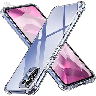 Ốp lưng dẻo xiaomi mi 10t/ 10t pro/ k30s
