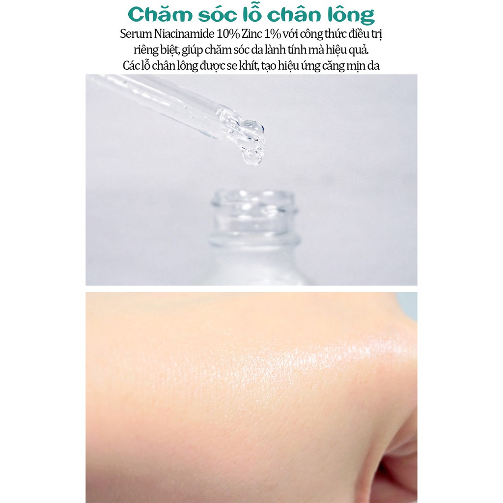 Tinh Chất Dưỡng Trắng Mịn, Cải Thiện Các Khuyết Điểm Của Da Care:nel Niacinamide 10% + Zinc 1% Serum 30ml