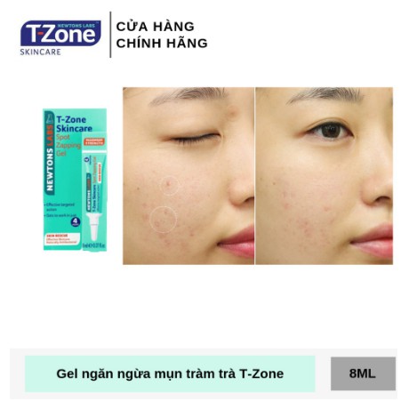 Gel giảm mụn và thâm cấp tốc T-ZONE | BigBuy360 - bigbuy360.vn
