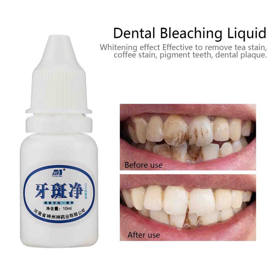Dung Dịch Làm Trắng Răng 10ml