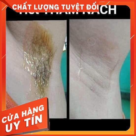 [Chính hãng]Combo Triệt Lông Wax + Mỡ Trăn handmade Shiny (tặng kèm dụng cụ wax) | BigBuy360 - bigbuy360.vn