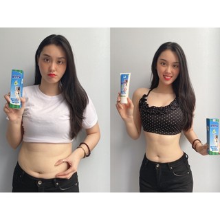 gel huỷ mỡ Only Slim