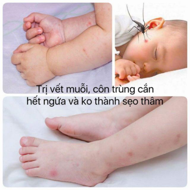 Serum sắc mộc nương thần thánh nhà em. Ngoài tác dụng làm hồng mọi chỗ, còn có những tác dụng thần thánh lắm ah🌹🌹🌹🌹