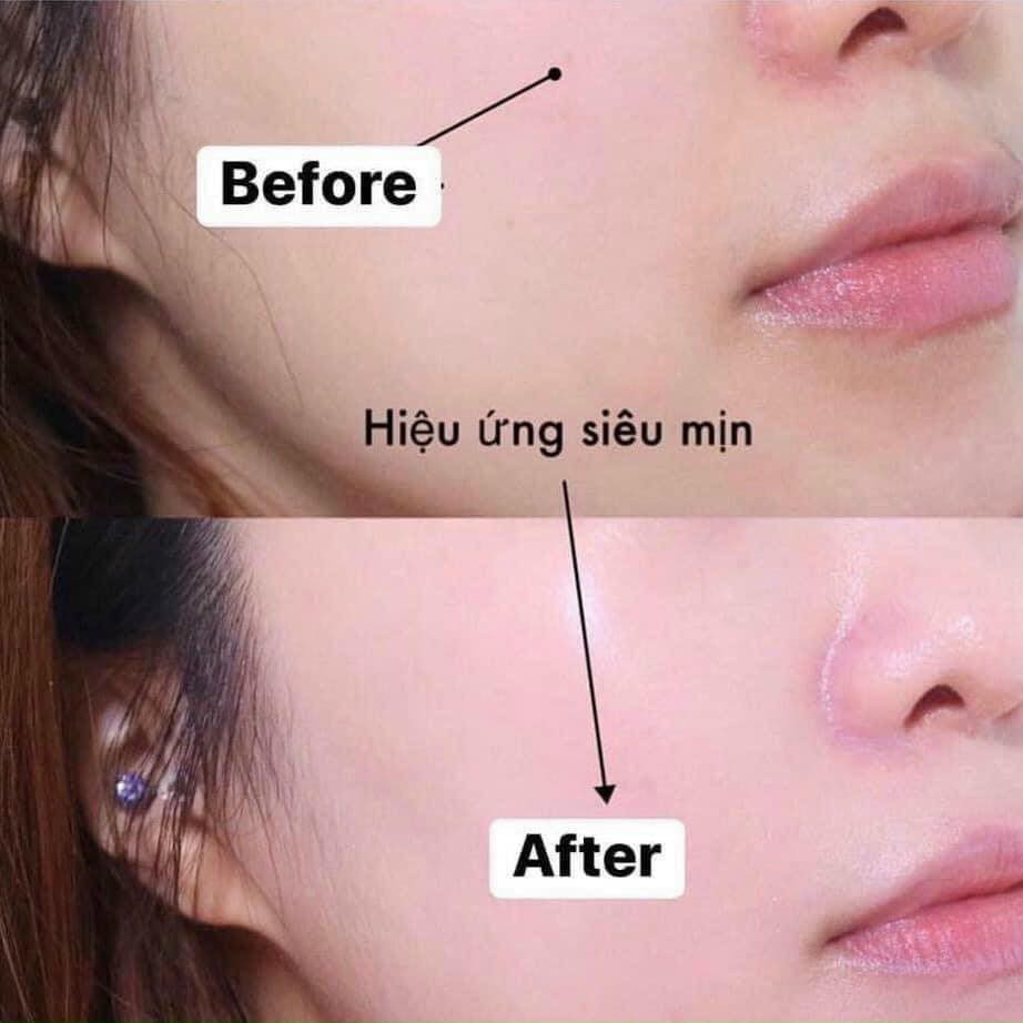 [CHÍNH HÃNG] Kem Chống Nắng Cell Fushion C | BigBuy360 - bigbuy360.vn