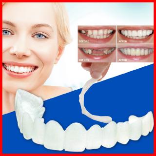 Bộ nẹp răng giả tự nhiên cao cấp