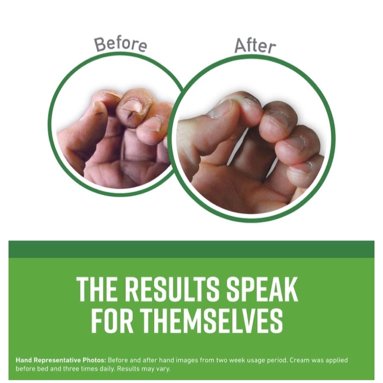 Kem giảm nứt gót chân, da tay, body O’Keeffe’s Working Hands Hand  Healthy Feet Foot Cream, and Skin Repair Body USA