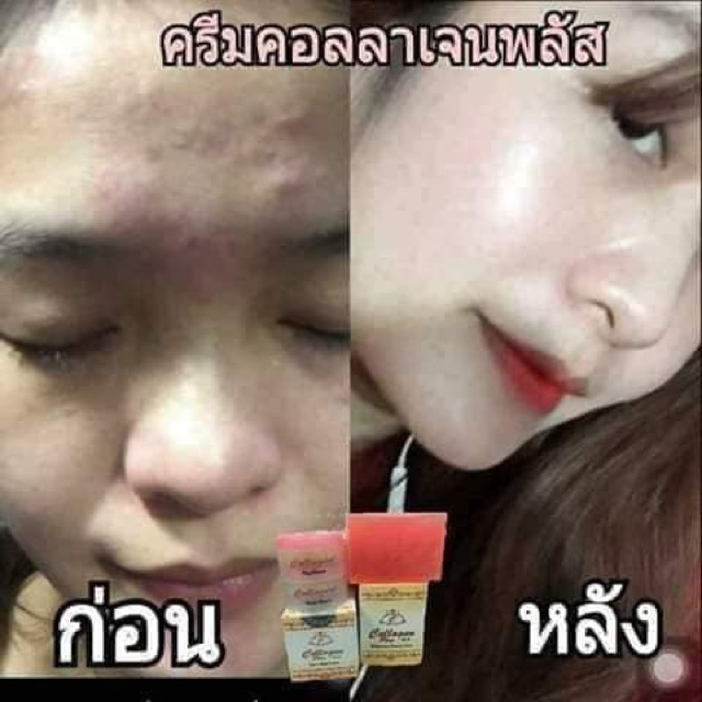 Collagen plus vit e giá chỉ 60.000₫