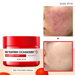 [Tea Tree Đỏ] Kem dưỡng da mụn Some By Mi Red Tea Tree Cicassoside Final Solution Cream 60g