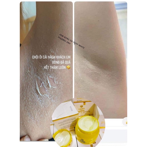 Kem Body Bong Da Phương Anh