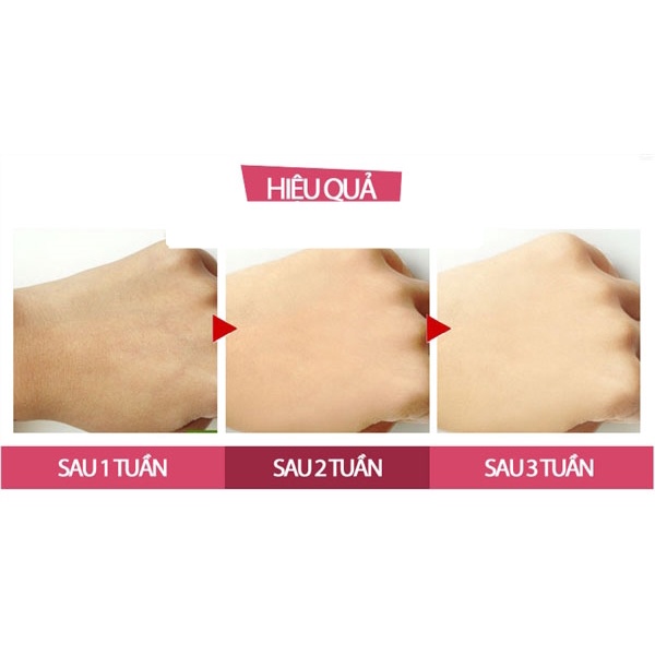 Kem Ủ Trắng Da Toàn Thân Ecosy 150ml | BigBuy360 - bigbuy360.vn