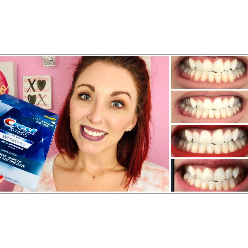 Miếng dán tẩy trắng răng Oral-b 3D white whitestrips luxe advanced seal 14 miếng của Úc