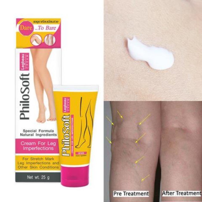 Tuýp 25g kem làm mờ rạn da do suy giãn tĩnh mạch Philosoft LegActif Cream