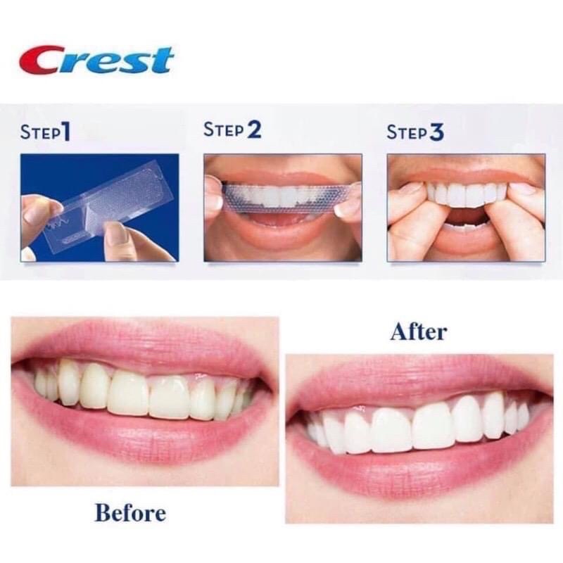 Miếng dán trắng răng Crest 3D White Whitestrips Teeth Whitening Kit