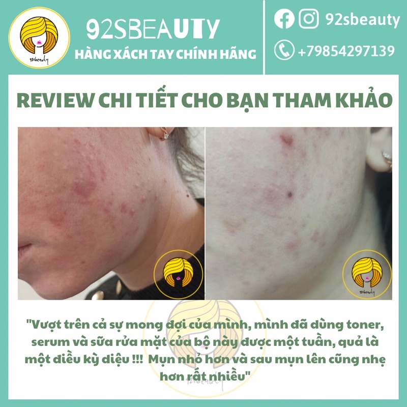 Toner Bielenda Dr Medica Anti-Acne Dermatological Toning Liqid làm sạch sâu và dịu da, giảm mụn, kiềm dầu nhờn