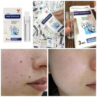 (Chính Hãng)Gel Tẩy Nốt Ruồi Nga
