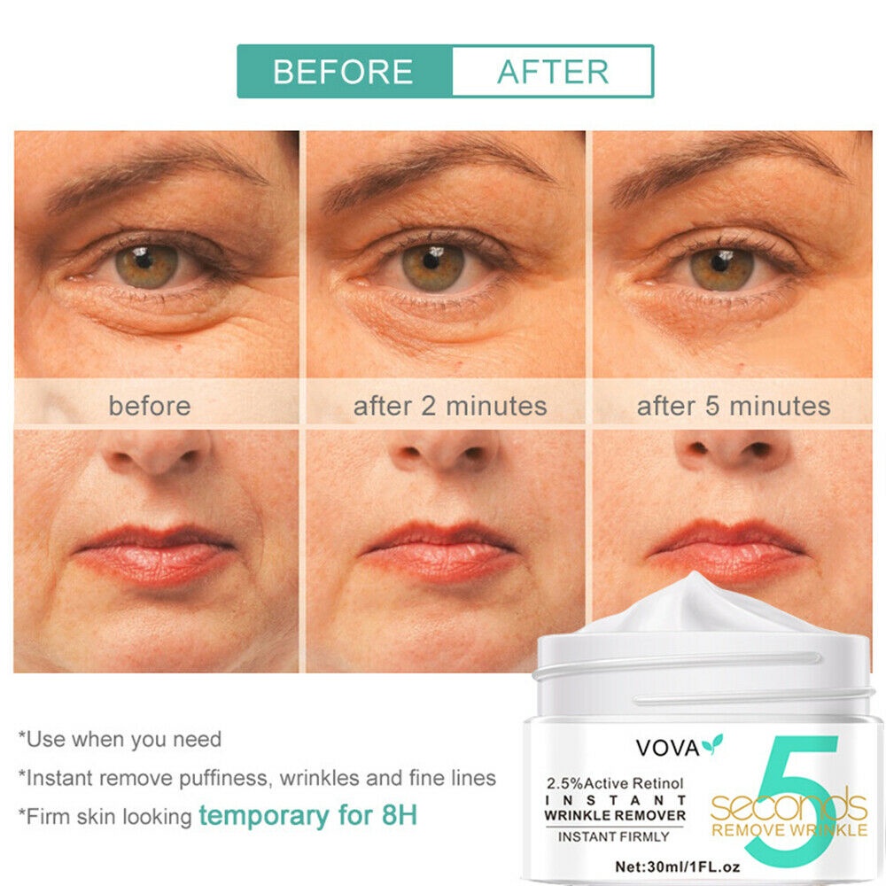 Kem Xóa Nếp Nhăn 5 Giây Chống Lão Hóa Làm Săn Chắc Da