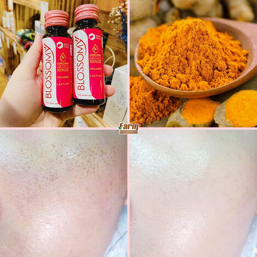 Lốc 10 chai x 50ml Nước Uống Đẹp Da, Cải Thiện Sức Khỏe Blossomy + Tặng Hộp Xếp Blossomy | BigBuy360 - bigbuy360.vn