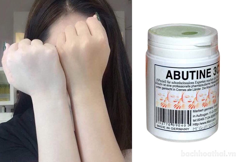 Kích trắng  Abutine 3C3