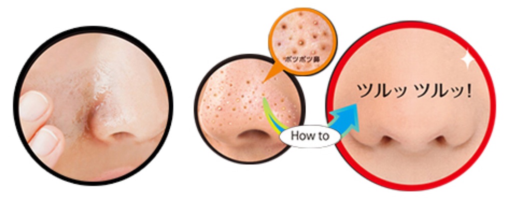 🦀🦀🦀 Gel lấy mụn Tsururi Pore Cleansing