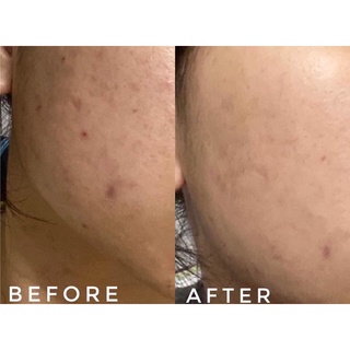 (Mẫu mới) Serum CC melano mờ thâm sáng da