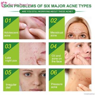 ELAIMEI Coco Tea Tree Acne Patch Hydrocolloid Waterproof Clear Pimple Patch Acne Treatment Patch