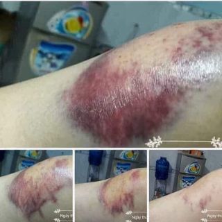 Cao ayofa relax chăm sóc sức khỏe