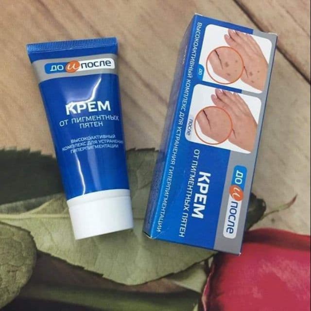 Kem Ngừa Nám Và Tàn Nhang Kpem SPF 20 NGA 100ml cam kết hết nám, tàn nhang nhé