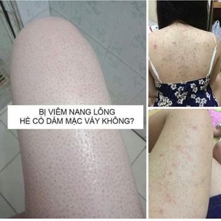 Muối Tắm Linh nhâm mẫu mới