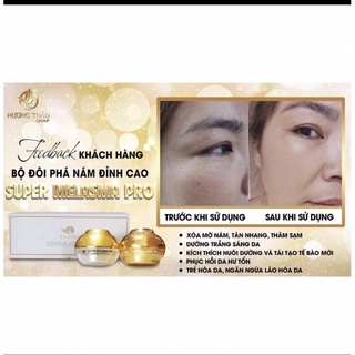 Bộ Đôi Phá Nám gấp 2 lần - SUPER MELASMA PRO