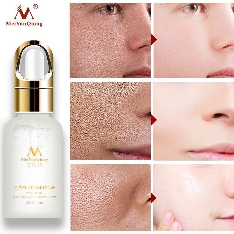 [Có Hàng Sẵn] MeiYanQiong Serum Cấp Nước Se Khít Lỗ Chân Lông Chiết Xuất Cây Phỉ Se Khít Lỗ Chân Lông Và Kiểm Soát Dầu