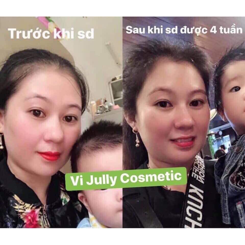 [TẶNG CỘT TÓC XINH] Dầu gội bưởi VIJULLYGIẢM RỤNG TÓC PHỤC HỒI TÓC HƯ TỔN HIỆU QUẢ SAU 2 TUẦN  280ml/1chai | BigBuy360 - bigbuy360.vn