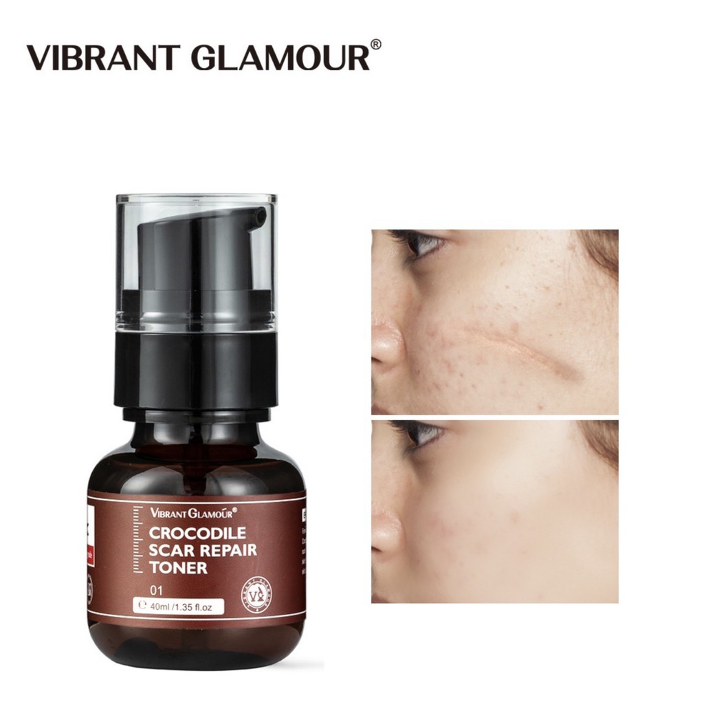 Serum dầu cá sấu cắt đáy sẹo rỗ,tinh chất làm đầy sẹo lõm sẹo rỗ,lỗ chân lông,se khít nang lông