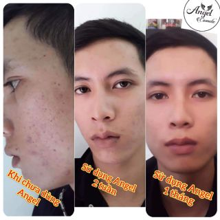 KEM FACE ANGEL CREAM