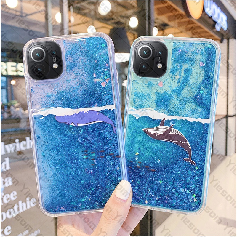 Ốp điện thoại silicon mềm phối kim tuyến nước cho Xiaomi Mi 11T 10T Pro Mi11 Lite Poco X3 NFC GT M3 Pro F3