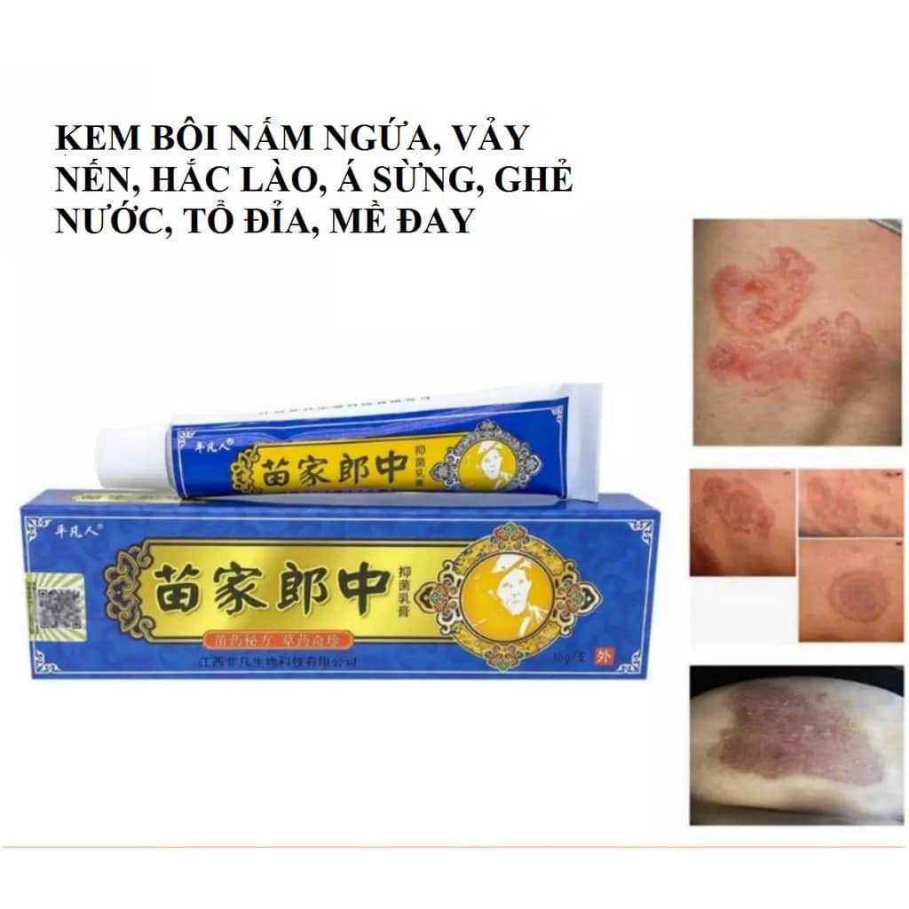 Kem bôi đông y da liễu trung hoa giảm ngứa, chàm, nứt nẻ, vảy nến , á sừng ...