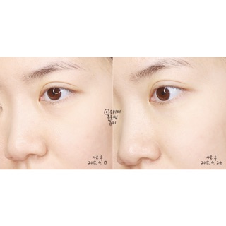 Tẩy da chết Cosrx AHA 7 WHITEHEAD POWDER LIQUID