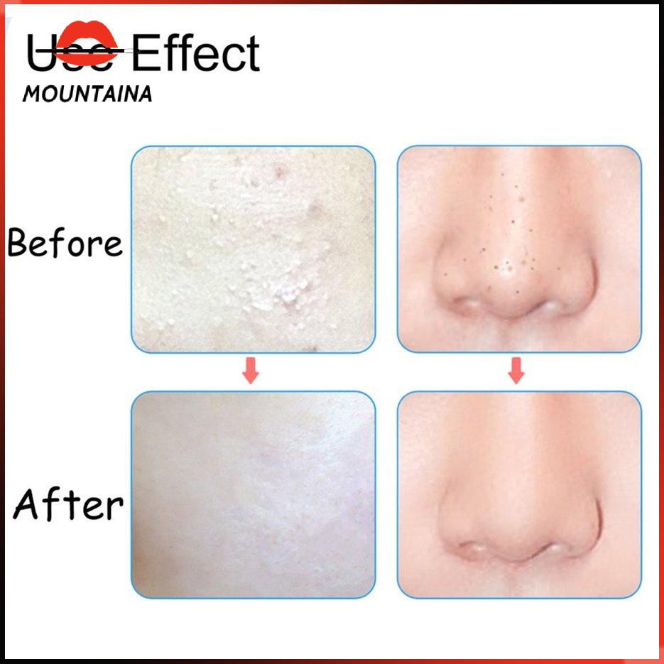 Nhíp nhổ lông, tóc bạc loại chắc | BigBuy360 - bigbuy360.vn