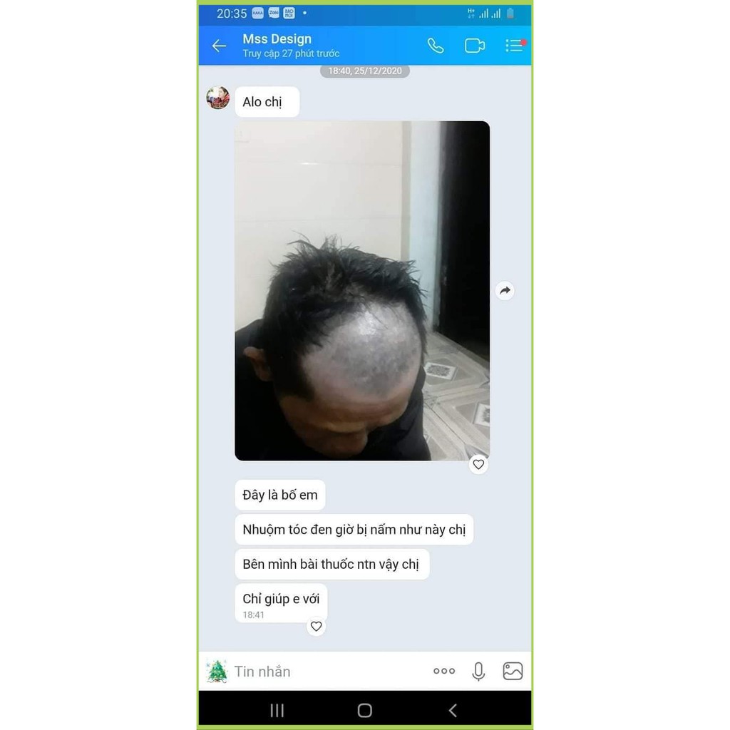 Dầu Gội Thảo Dược Comeon Hết Gàu - Giảm Rụng Tóc - Kích Thích Mọc Tóc - Chuẩn 100% | BigBuy360 - bigbuy360.vn