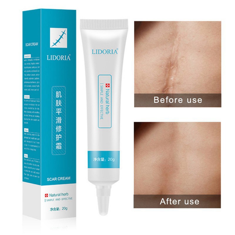 [Hàng mới về] Kem chăm sóc da mặt LIDUOLIYA 20g hydrat hóa loại bỏ sẹo mụn cho da mịn màng | BigBuy360 - bigbuy360.vn