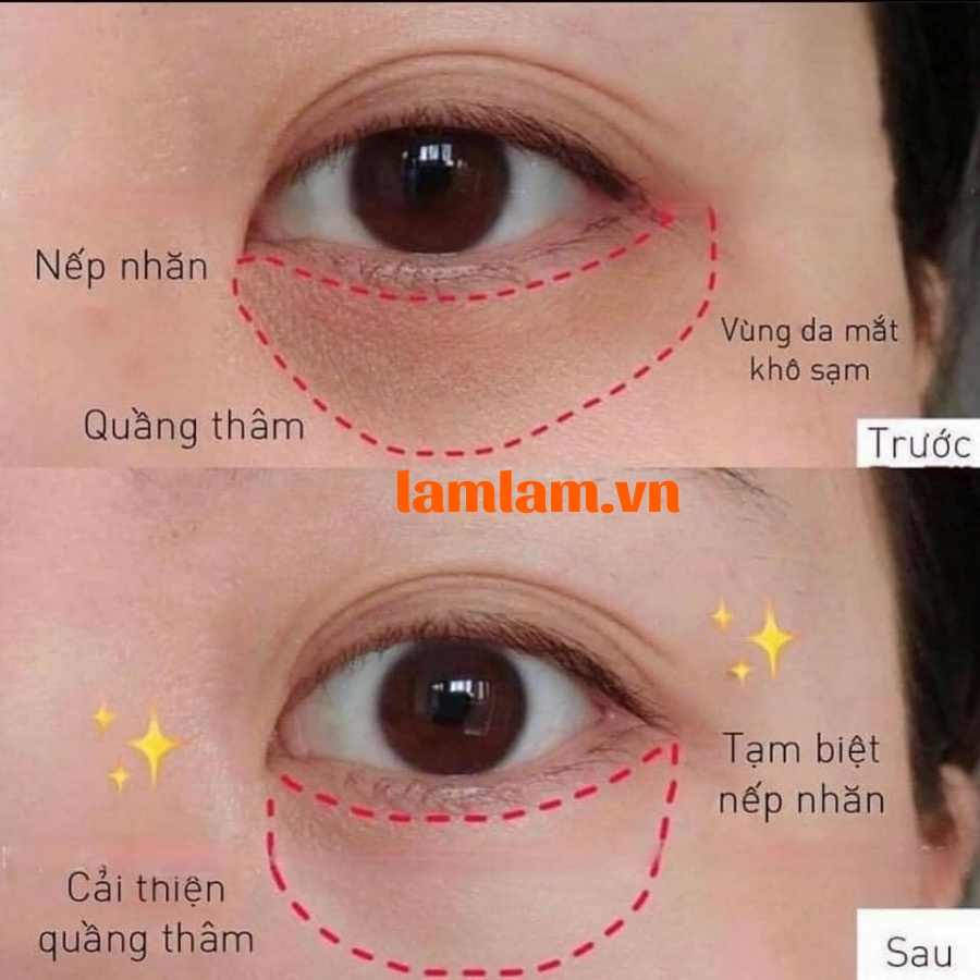 Kem mắt The INKEY Caffeine Eye Cream Serum 15ml
