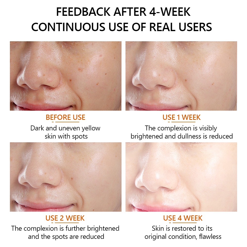 Serum Vitamin C Vibrant GLAMOUR Dưỡng Ẩm Làm Trắng Sáng Da Chống Lão Hóa Loại Bỏ Đốm Đen 30ml | BigBuy360 - bigbuy360.vn