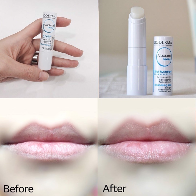 Son dưỡng môi Bioderma Atoderm Lèvres Stick Hydratant Moisturising Pháp