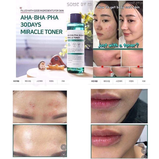 Nước hoa hồng SOME BY MI 30 DAYS MIRACLE TONER