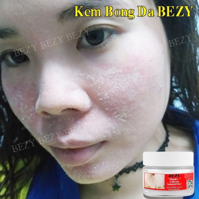 Kem Bong Da Mặt Trắng Da Mờ Thâm Nám